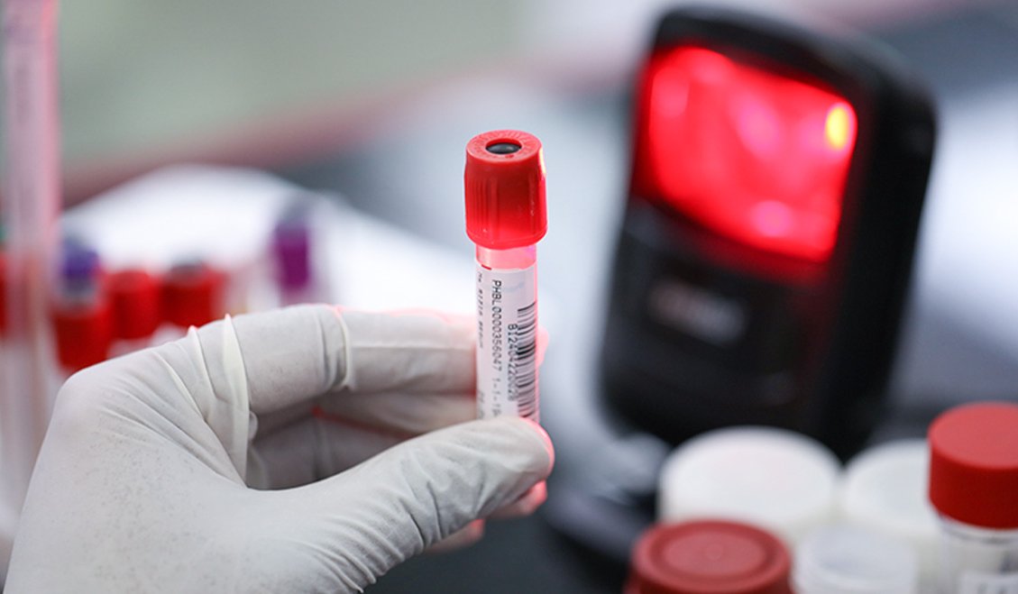 Press_ CME Molecular Cancer